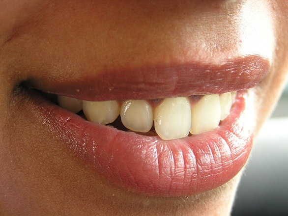 A ragyogó fehér fogakhoz az emberek az egészségességet párosítják a tudat alatt